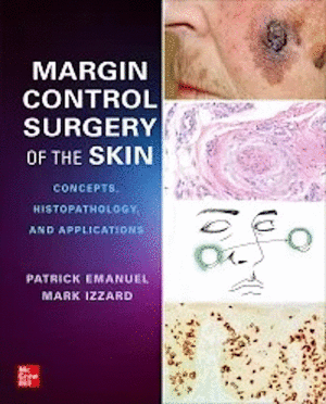 MARGIN CONTROL SURGERY OF THE SKIN. CONCEPTS, HISTOPATHOLOGY, AND APPLICATIONS