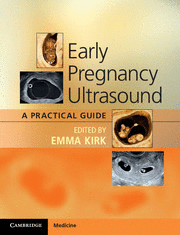 EARLY PREGNANCY ULTRASOUND. A PRACTICAL GUIDE