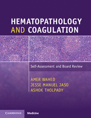 HEMATOPATHOLOGY AND COAGULATION BOARD REVIEW. QUESTIONS, ANSWERS AND EXPLANATIONS
