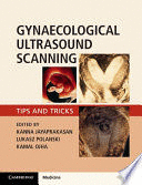GYNAECOLOGICAL ULTRASOUND SCANNING. TIPS AND TRICKS