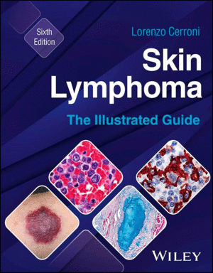 SKIN LYMPHOMA. THE ILLUSTRATED GUIDE. 6TH EDITION