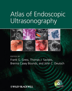 ATLAS OF ENDOSCOPIC ULTRASONOGRAPHY + DVD-ROM