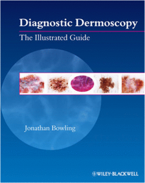 DIAGNOSTIC DERMOSCOPY: THE ILLUSTRATED GUIDE