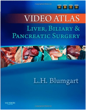 VIDEO ATLAS: LIVER, BILIARY & PANCREATIC SURGERY. EXPERT CONSULT - ONLINE AND PRINT