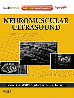 NEUROMUSCULAR ULTRASOUND + EXPERT CONSULT