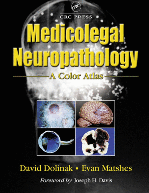 MEDICOLEGAL NEUROPATHOLOGY. A COLOR ATLAS. 2ND EDITION