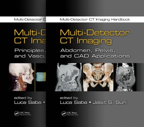MULTI-DETECTOR CT IMAGING HANDBOOK, 2 VOLUME SET