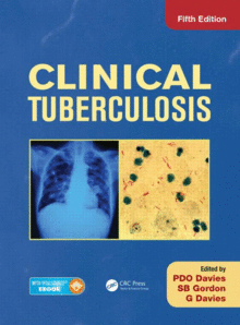CLINICAL TUBERCULOSIS, 5TH EDITION