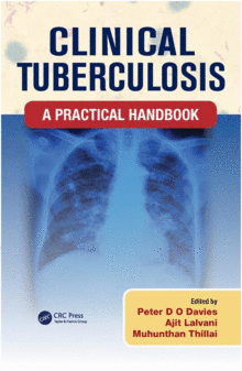 CLINICAL TUBERCULOSIS: A PRACTICAL HANDBOOK
