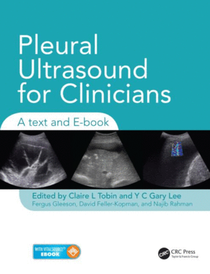 PLEURAL ULTRASOUND FOR CLINICIANS. A TEXT AND E-BOOK