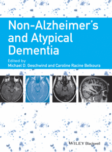 NON-ALZHEIMER�S DEMENTIA