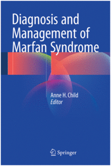 DIAGNOSIS AND MANAGEMENT OF MARFAN SYNDROME