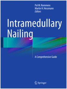 INTRAMEDULLARY NAILING. A COMPREHENSIVE GUIDE