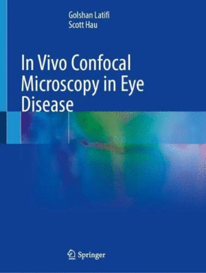 IN VIVO CONFOCAL MICROSCOPY IN EYE DISEASE