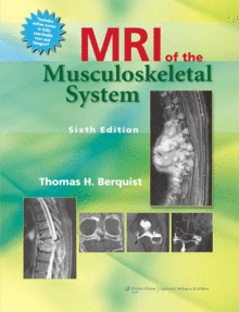 MRI OF THE MUSCULOSKELETAL SYSTEM. 6TH EDITION