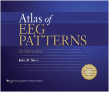 ATLAS OF EEG PATTERNS. 2ND EDITION