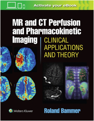 MR & CT PERFUSION IMAGING: CLINICAL APPLICATIONS AND THEORETICAL PRINCIPLES