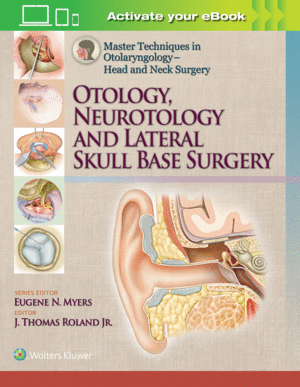 MASTER TECHNIQUES IN OTOLARYNGOLOGY  HEAD AND NECK SURGERY