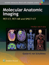 MOLECULAR ANATOMIC IMAGING. PET/CT, PET/MR AND SPECT CT