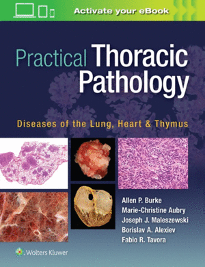 PRACTICAL THORACIC PATHOLOGY. DISEASES OF THE LUNG, HEART, AND THYMUS