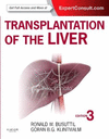 TRANSPLANTATION OF THE LIVER, 3RD EDITION