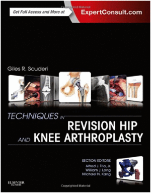 TECHNIQUES IN REVISION HIP AND KNEE ARTHROPLASTY.