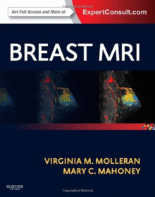 BREAST MRI
