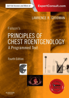 FELSON'S PRINCIPLES OF CHEST ROENTGENOLOGY, A PROGRAMMED TEXT, 4TH EDITION