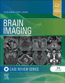 BRAIN IMAGING: CASE REVIEW SERIES. 3RD EDITION
