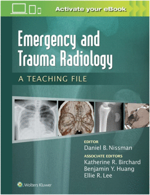 EMERGENCY AND TRAUMA RADIOLOGY: A TEACHING FILE