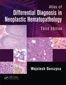 ATLAS OF DIFFERENTIAL DIAGNOSIS IN NEOPLASTIC HEMATOPATHOLOGY