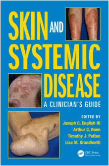 SKIN AND SYSTEMIC DISEASE: A CLINICIANS GUIDE