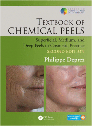 TEXTBOOK OF CHEMICAL PEELS: SUPERFICIAL, MEDIUM, AND DEEP PEELS IN COSMETIC PRACTICE. 2ND EDITION