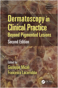 DERMATOSCOPY IN CLINICAL PRACTICE, 2ND EDITION: BEYOND PIGMENTED LESIONS