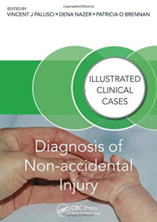 DIAGNOSIS OF NON-ACCIDENTAL INJURY. ILLUSTRATED CLINICAL CASES