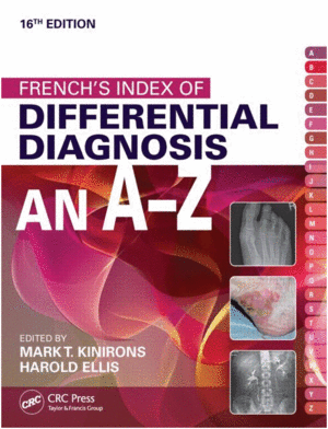 FRENCH'S INDEX OF DIFFERENTIAL DIAGNOSIS AN A-Z. 16TH EDITION