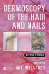 DERMOSCOPY OF THE HAIR AND NAILS, SECOND EDITION