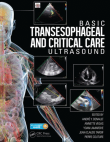 BASIC TRANSESOPHAGEAL AND CRITICAL CARE ULTRASONOGRAPHY
