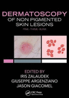 DERMATOSCOPY OF NON-PIGMENTED SKIN TUMORS: PINK - THINK - BLINK