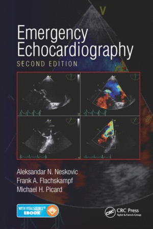 EMERGENCY ECHOCARDIOGRAPHY, 2ND EDITION. BOOK+EBOOK