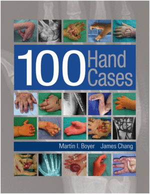 100 HAND CASES. BOOK + EBOOK