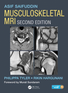 MUSCULOSKELETAL MRI, 2ND EDITION. BOOK + EBOOK