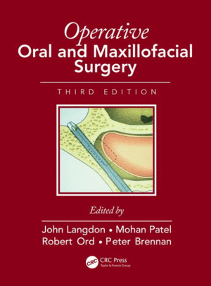 OPERATIVE ORAL AND MAXILLOFACIAL SURGERY, 3RD EDITION