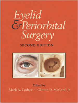 EYELID AND PERIORBITAL SURGERY, 2ND EDITION. (BOOK + EBOOK)