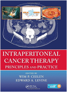 INTRAPERITONEAL CANCER THERAPY. PRINCIPLES AND PRACTICE