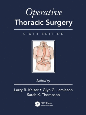 OPERATIVE THORACIC SURGERY. 6TH EDITION  (BOOK + EBOOK)