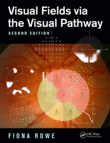 VISUAL FIELDS VIA THE VISUAL PATHWAY, 2ND EDITION