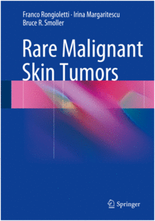 RARE MALIGNANT SKIN TUMORS