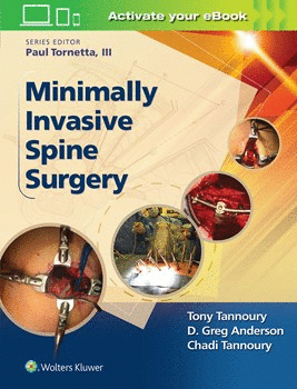 MINIMALLY INVASIVE SPINE SURGERY