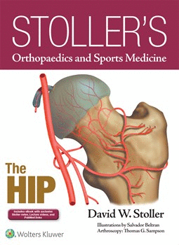 STOLLER'S ORTHOPAEDICS AND SPORTS MEDICINE. THE HIP